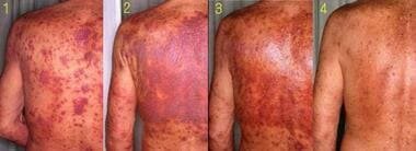 dianabol cycle results